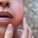 Dor de dente afasta trabalhadores e reduz produtividade no Amazonas