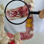 Casos de doenças intestinais aumentam cinco vezes no Brasil